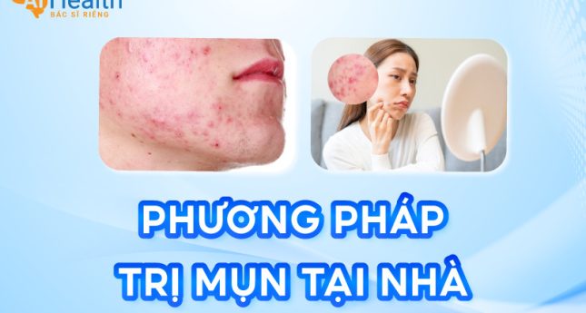 8 Cách trị mụn tại nhà do chuyên gia đề xuất